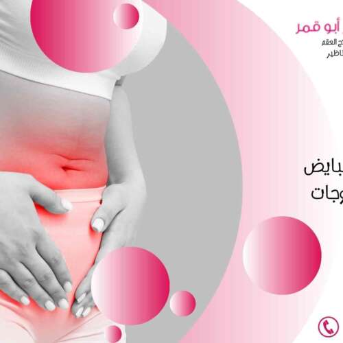 علاج-تكيس-المبايض-للبنات-والمتزوجات