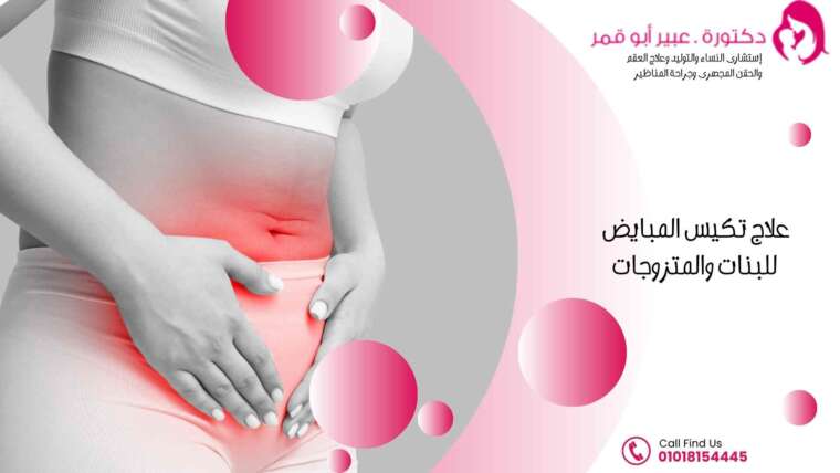 علاج-تكيس-المبايض-للبنات-والمتزوجات