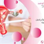 بطانة الرحم المهاجرة وتأخر الحمل: ما العلاقة بينهما؟