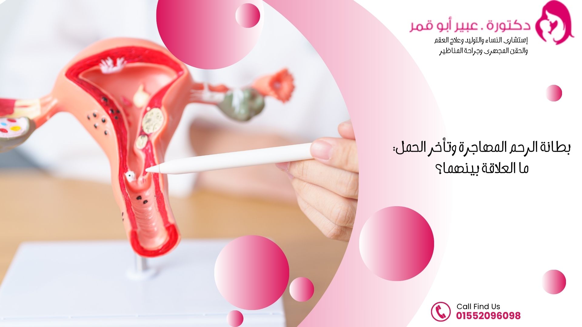 بطانة-الرحم-المهاجرة-وتأخر-الحمل