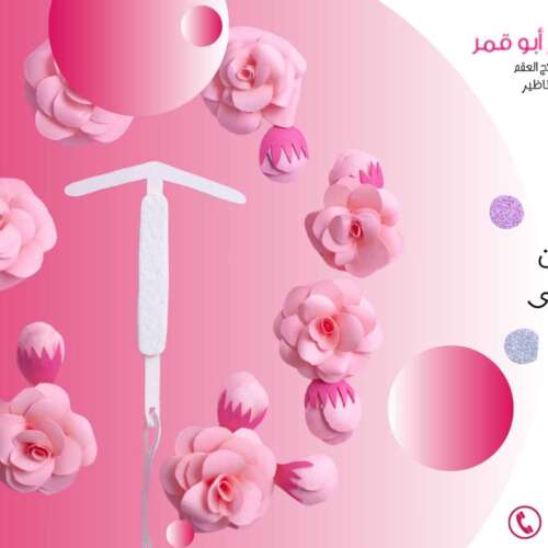 دليل-شامل-عن-اللولب-الهرموني