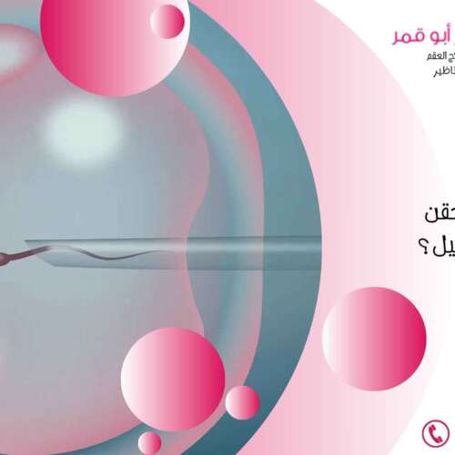 ماهى-مراحل-الحقن-المجهري-بالتفصيل