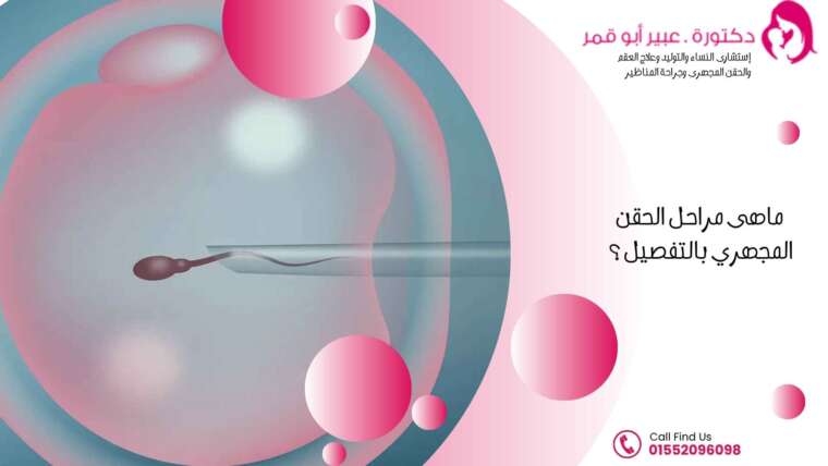 ماهى-مراحل-الحقن-المجهري-بالتفصيل
